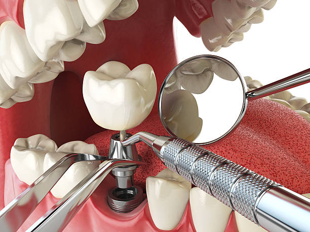 Best Urgent Dental Care for Toothache in Shoh, IL