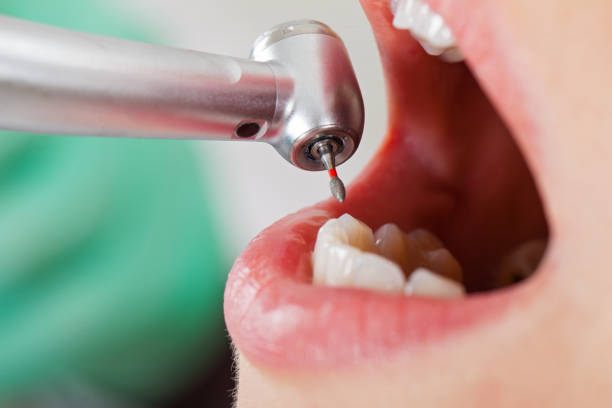 Best Emergency Dentist for Special Needs Patients in Shoh, IL